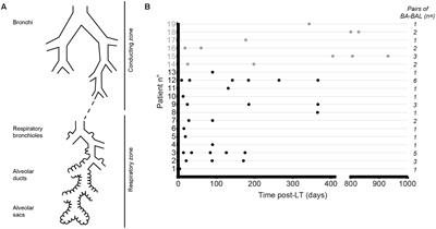 Microbial Communities of Conducting and Respiratory Zones of Lung-Transplanted Patients